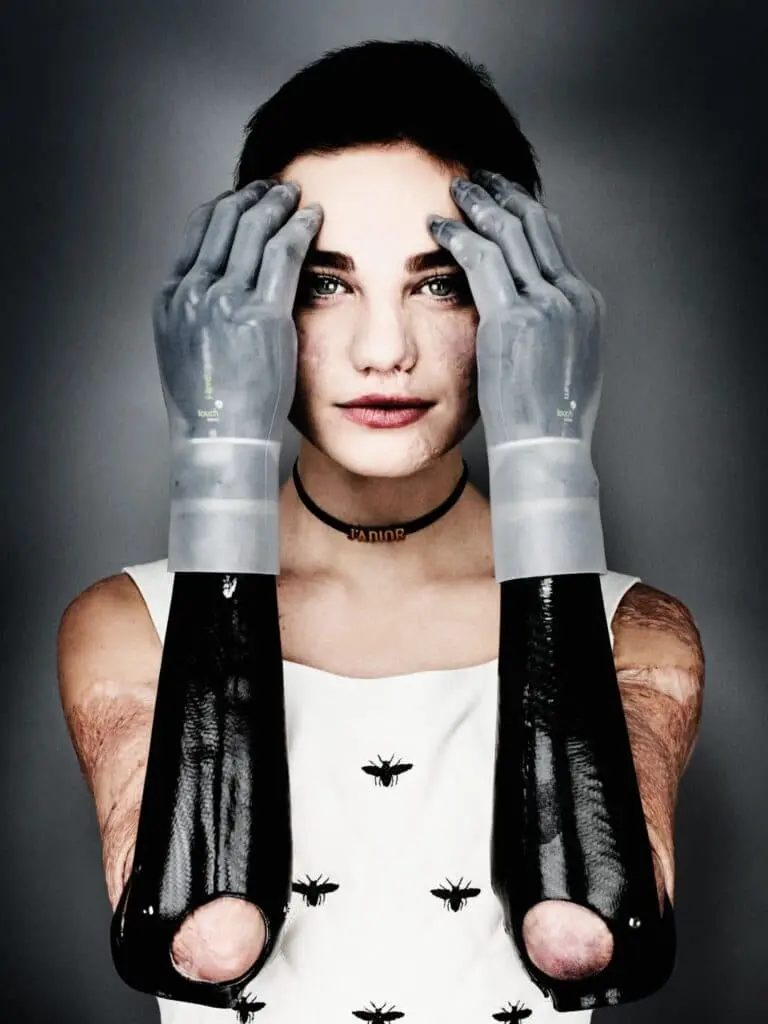 Bebe Vio di Giovanni Gastel